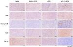 Granzyme B Antibody in Immunohistochemistry (IHC)