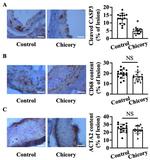 CD68 Antibody in Immunohistochemistry (IHC)