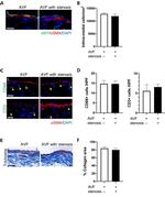 Alpha-Smooth Muscle Actin Antibody in Immunohistochemistry (IHC)