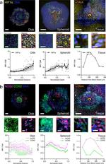 Alpha-Smooth Muscle Actin Antibody in Immunohistochemistry (IHC)