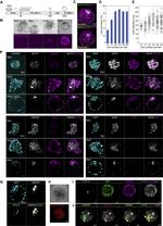 GATA3 Antibody in Immunocytochemistry (ICC/IF)