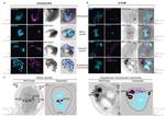 alpha Tubulin Antibody in Immunohistochemistry (IHC)