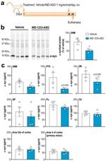 alpha Synuclein Antibody in Western Blot (WB)