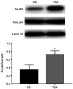 Lamin B1 Antibody in Western Blot (WB)