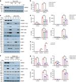 Phospho-STAT1 (Tyr701) Antibody in Western Blot (WB)