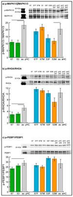 PEBP1 Antibody in Western Blot (WB)