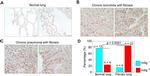 MINA53 Antibody in Immunohistochemistry (Paraffin) (IHC (P))