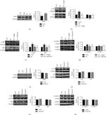 Phospho-SGK1 (Thr256) Antibody in Western Blot (WB)