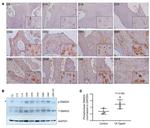 Phospho-SMAD2 (Ser465, Ser467) Antibody in Immunohistochemistry (IHC)