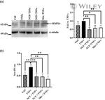 MMP14 Antibody in Western Blot (WB)