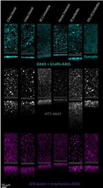 Tau Antibody in Immunohistochemistry (IHC)