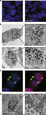 6x-His Tag Antibody in Immunocytochemistry (ICC/IF)