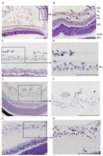 FITC Antibody in Immunohistochemistry (IHC)