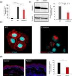 Claudin 1 Antibody in Immunohistochemistry (IHC)