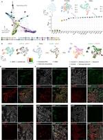 Claudin 1 Antibody in Immunohistochemistry (IHC)