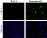 Alexa Fluor 488 Antibody in Immunocytochemistry (ICC/IF)