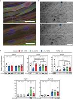 Sarcomeric alpha Actinin Antibody in Immunocytochemistry (ICC/IF)