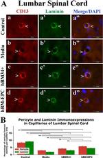 CD13 Antibody in Immunohistochemistry (IHC)