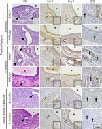 Progesterone Receptor Antibody in Immunohistochemistry (IHC)