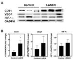 HIF1A Antibody in Western Blot (WB)