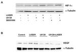 HIF1A Antibody in Western Blot (WB)