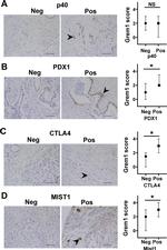 Mist1 Antibody in Immunohistochemistry (IHC)