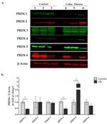 PRDX1 Antibody in Western Blot (WB)