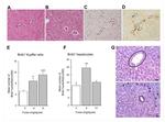 BrdU Antibody in Immunohistochemistry (IHC)