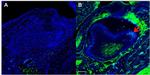 CaV1.1 Antibody in Immunohistochemistry (IHC)