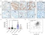 TGM2 Antibody in Immunohistochemistry (IHC)