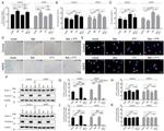 p21 Antibody in Immunocytochemistry (ICC/IF)