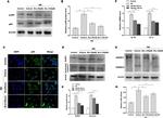 Phospho-NFkB p65 (Ser536) Antibody in Western Blot (WB)