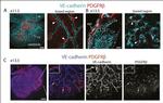 CD140b (PDGFRB) Antibody in Immunohistochemistry (IHC)