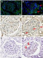 Axl Antibody in Immunohistochemistry (IHC)