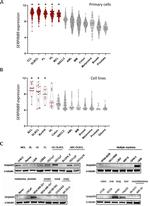 SERPINB9 Antibody in Western Blot (WB)