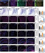 Norepinephrine Transporter Antibody in Immunohistochemistry (IHC)