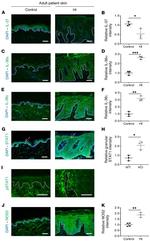 IL1F9 Antibody in Immunohistochemistry (IHC)