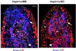 Aggrecan Antibody