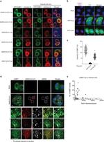 SARS/SARS-CoV-2 Nucleocapsid Antibody in Immunocytochemistry (ICC/IF)