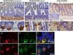 Lysozyme Antibody in Immunohistochemistry (IHC)