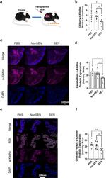 Klotho Antibody in Immunohistochemistry (Paraffin) (IHC (P))