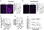 Klotho Antibody in Immunohistochemistry (Paraffin) (IHC (P))