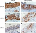 ALDH1A1 Antibody in Immunohistochemistry (IHC)