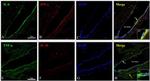 IFN gamma Antibody in Immunohistochemistry (Paraffin) (IHC (P))