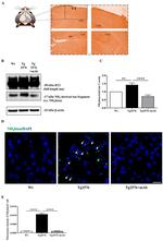 Tau Antibody in Western Blot (WB)