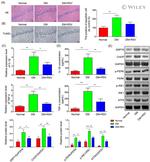 IRE1 alpha Antibody in Western Blot (WB)