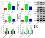 IRE1 alpha Antibody in Western Blot (WB)