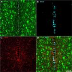 GFAP Antibody in Immunohistochemistry (IHC)