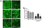 PGP9.5 Antibody in Immunocytochemistry (ICC/IF)