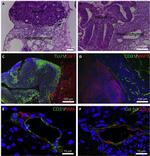 Collagen I Antibody in Immunohistochemistry (IHC)